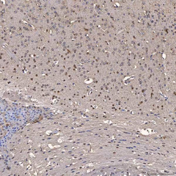 NOB1 Rabbit Polyclonal Antibody