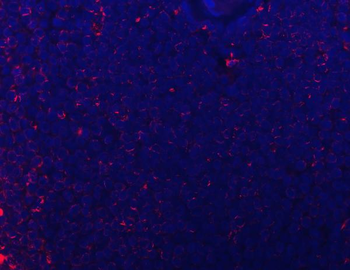 CD74 Rabbit Polyclonal Antibody