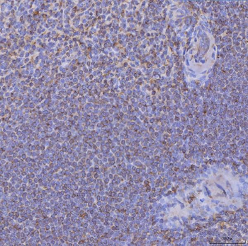 CD74 Rabbit Polyclonal Antibody
