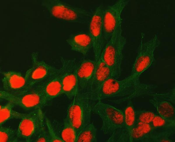 ATG4C Rabbit Polyclonal Antibody
