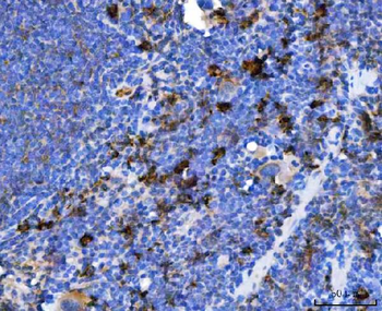 TXNDC5 Rabbit Polyclonal Antibody