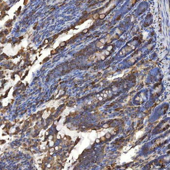 TXNDC5 Rabbit Polyclonal Antibody