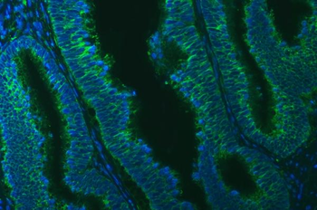 TXNDC5 Rabbit Polyclonal Antibody