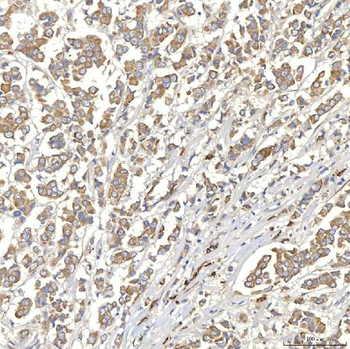 TXNDC5 Rabbit Polyclonal Antibody