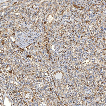 TXNDC5 Rabbit Polyclonal Antibody