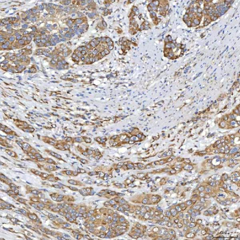 TXNDC5 Rabbit Polyclonal Antibody