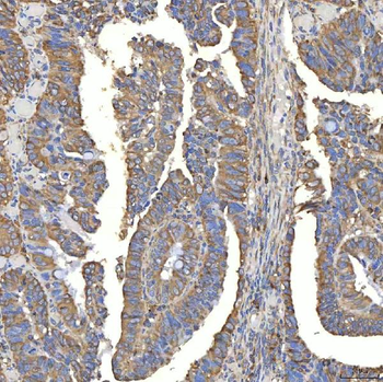 TXNDC5 Rabbit Polyclonal Antibody