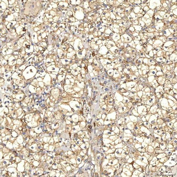 TXNDC5 Rabbit Polyclonal Antibody
