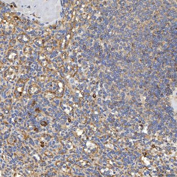 TXNDC5 Rabbit Polyclonal Antibody