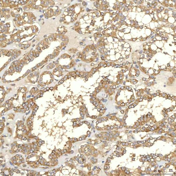TXNDC5 Rabbit Polyclonal Antibody