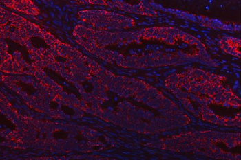 TST Rabbit Polyclonal Antibody