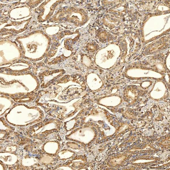 TST Rabbit Polyclonal Antibody