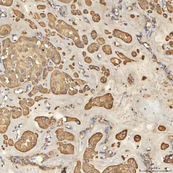 TST Rabbit Polyclonal Antibody
