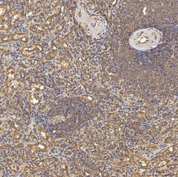 TST Rabbit Polyclonal Antibody