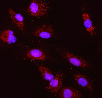 TST Rabbit Polyclonal Antibody