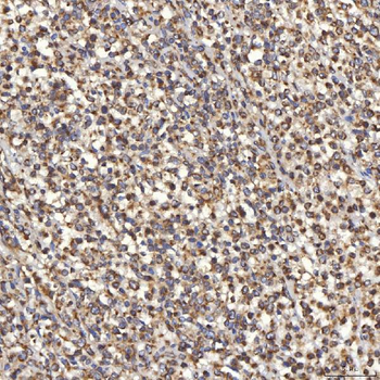 TST Rabbit Polyclonal Antibody