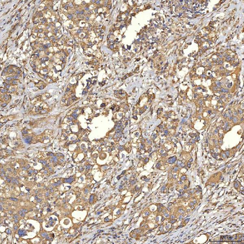 TST Rabbit Polyclonal Antibody