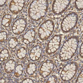 TST Rabbit Polyclonal Antibody