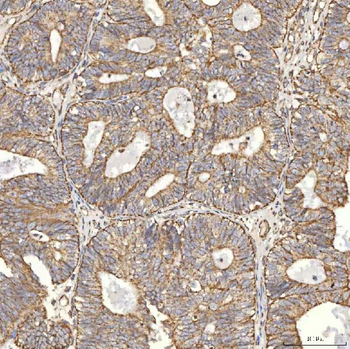 TST Rabbit Polyclonal Antibody