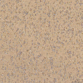 TST Rabbit Polyclonal Antibody