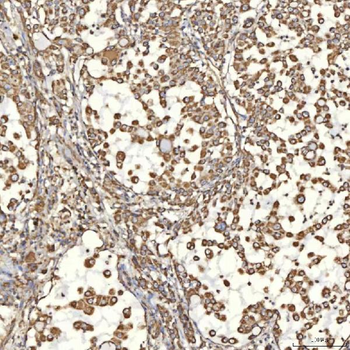 TST Rabbit Polyclonal Antibody