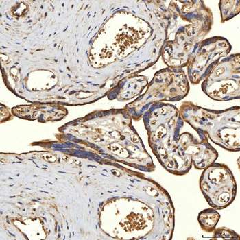 TST Rabbit Polyclonal Antibody