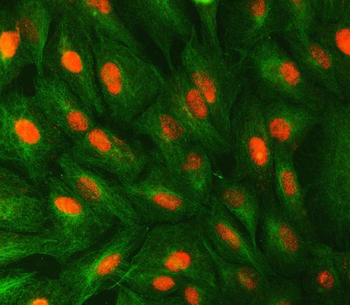 Syntaxin 6/STX6 Rabbit Polyclonal Antibody