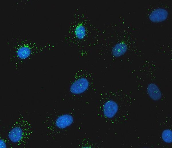 SNX1 Rabbit Polyclonal Antibody