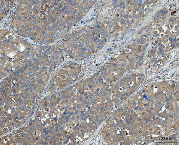 SNX1 Rabbit Polyclonal Antibody