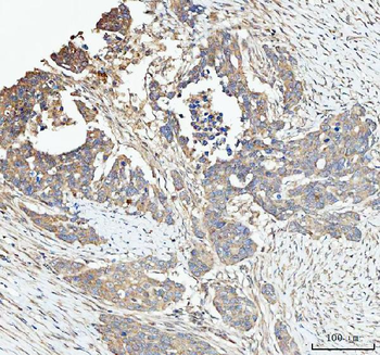 SNX1 Rabbit Polyclonal Antibody
