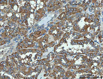 SNX1 Rabbit Polyclonal Antibody