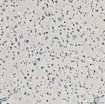 SNRPD2 Rabbit Polyclonal Antibody