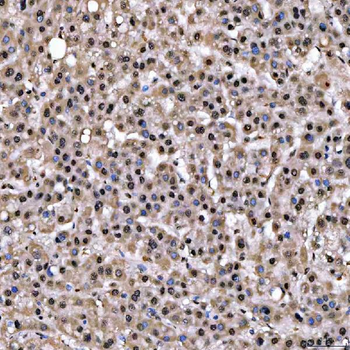 SNRPD2 Rabbit Polyclonal Antibody