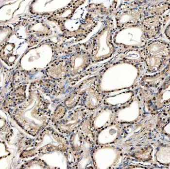 SNRPD2 Rabbit Polyclonal Antibody