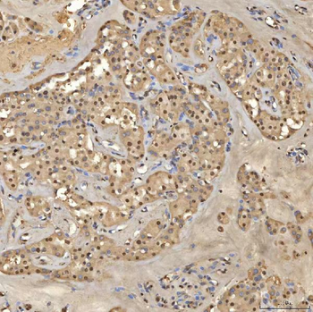 SNRPD2 Rabbit Polyclonal Antibody