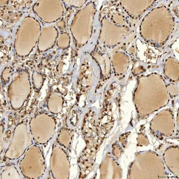 SNRPD2 Rabbit Polyclonal Antibody