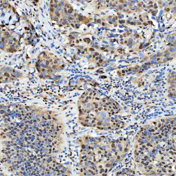 SNRPD2 Rabbit Polyclonal Antibody