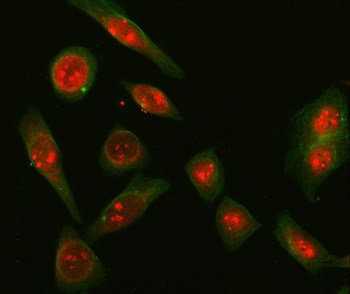 SNRPD2 Rabbit Polyclonal Antibody