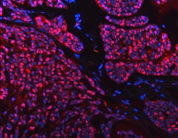 SNRPD2 Rabbit Polyclonal Antibody