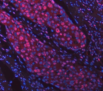 SNRPD2 Rabbit Polyclonal Antibody