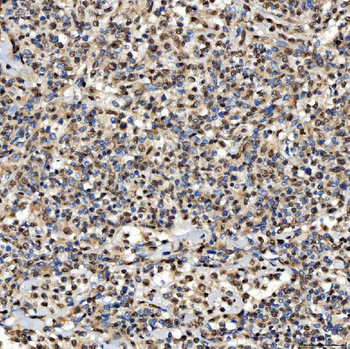 SNRPD2 Rabbit Polyclonal Antibody