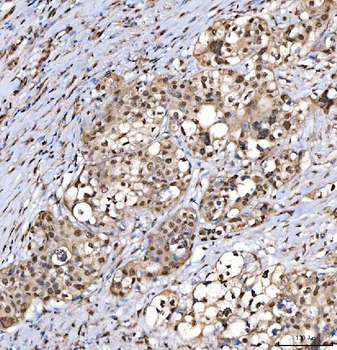 SNRPD2 Rabbit Polyclonal Antibody