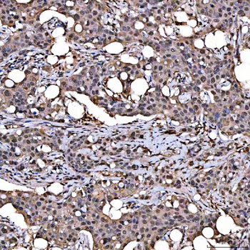 SNRPD2 Rabbit Polyclonal Antibody