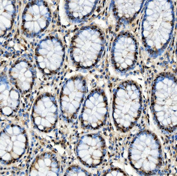 SNRPD2 Rabbit Polyclonal Antibody