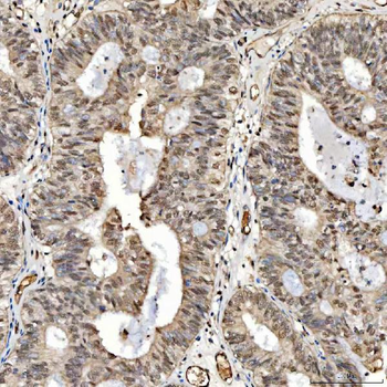 SNRPD2 Rabbit Polyclonal Antibody