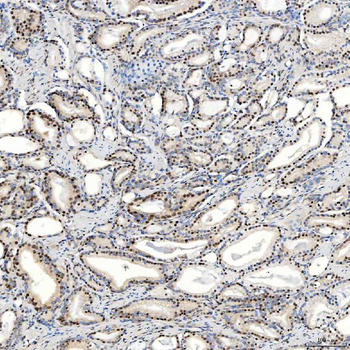 U1-C/SNRPC/U1 Rabbit Polyclonal Antibody