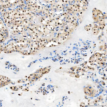 U1-C/SNRPC/U1 Rabbit Polyclonal Antibody