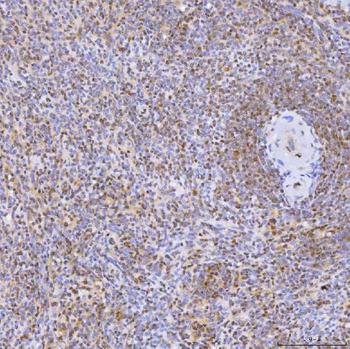 U1-C/SNRPC/U1 Rabbit Polyclonal Antibody