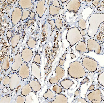 U1-C/SNRPC/U1 Rabbit Polyclonal Antibody
