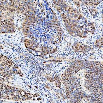 U1-C/SNRPC/U1 Rabbit Polyclonal Antibody